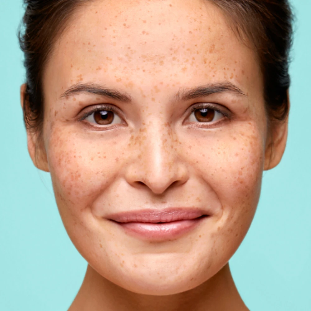 Biodermal Couperose Creme 2 Biodermal Couperose Creme - Afbeelding 2